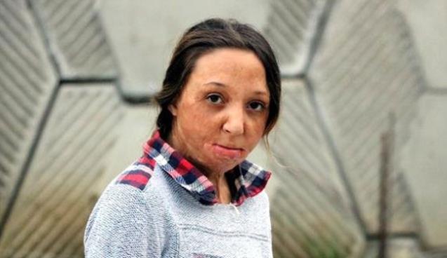 'Yaşaması mucize' denildi… Yardım bekliyor…