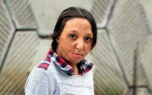 'Yaşaması mucize' denildi… Yardım bekliyor…