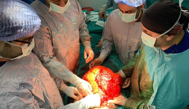 Karın şişliğiyle hastaneye başvurdu, 11 kiloluk kitle çıktı