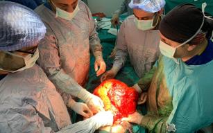 Karın şişliğiyle hastaneye başvurdu, 11 kiloluk kitle çıktı