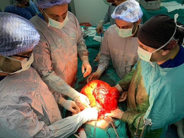 Karın şişliğiyle hastaneye başvurdu, 11 kiloluk kitle çıktı
