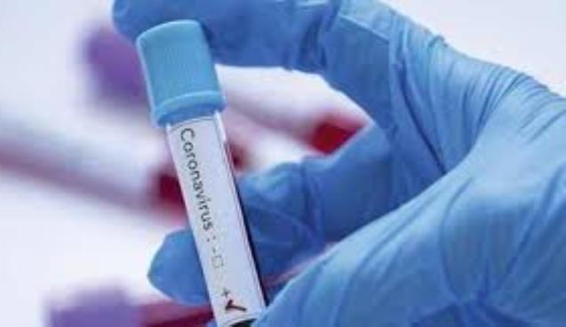 Düğüne giden 11 kişinin Corona Virüs testi pozitif çıktı