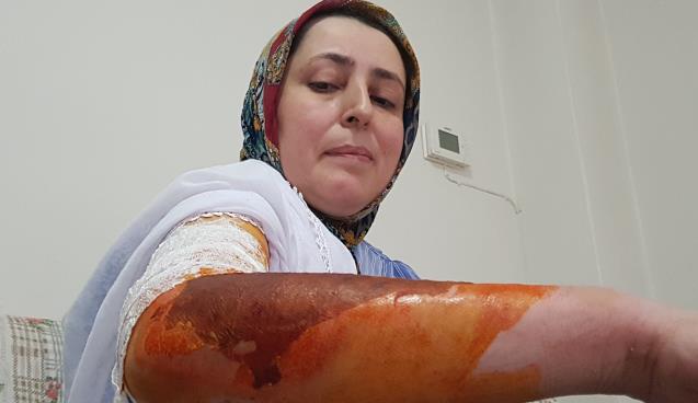 Cani koca misafirin yanında oturmadı diye eşini kaynar su