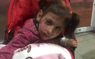 Kanser hastası kız için 3 saate 25 bin TL toplandı