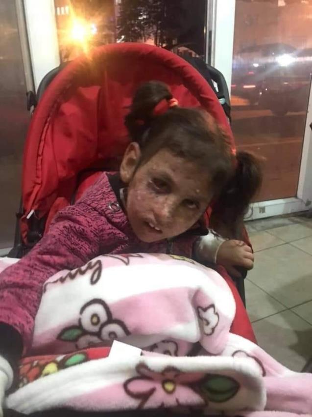 Kanser hastası kız için 3 saate 25 bin TL toplandı
